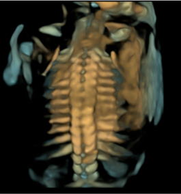 máy siêu âm máy siêu âm