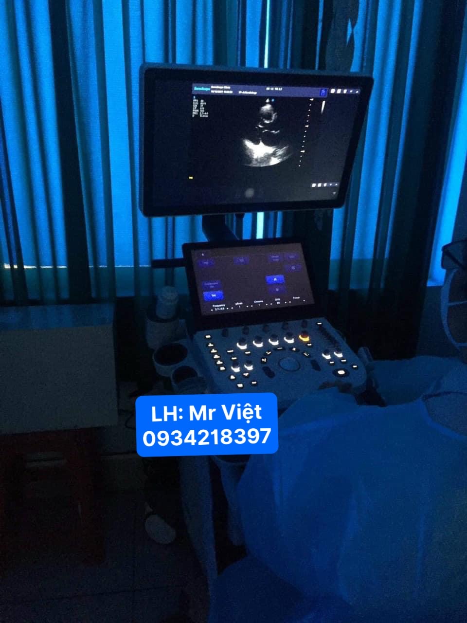 máy siêu âm 4d 5d sonoscape máy siêu âm 4d 5d sonoscape