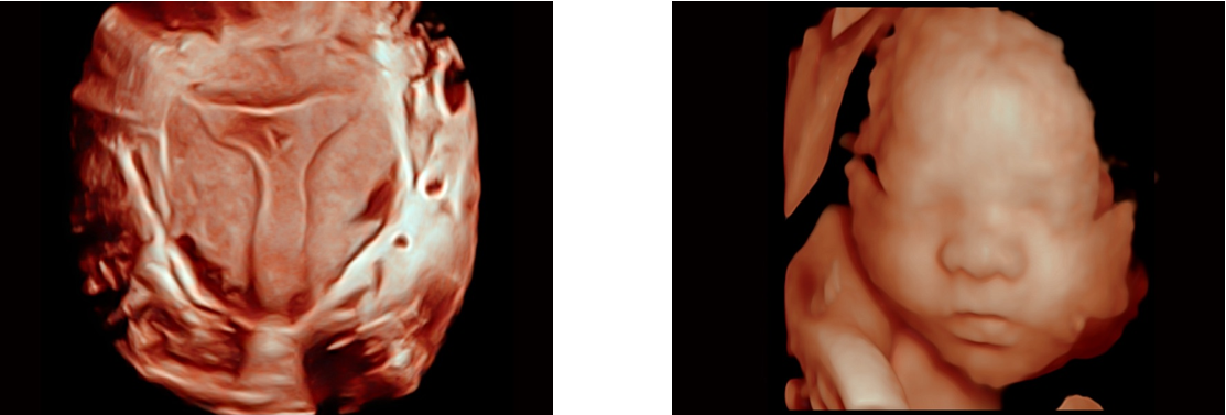 S-Live SonoScape S-Live SonoScape