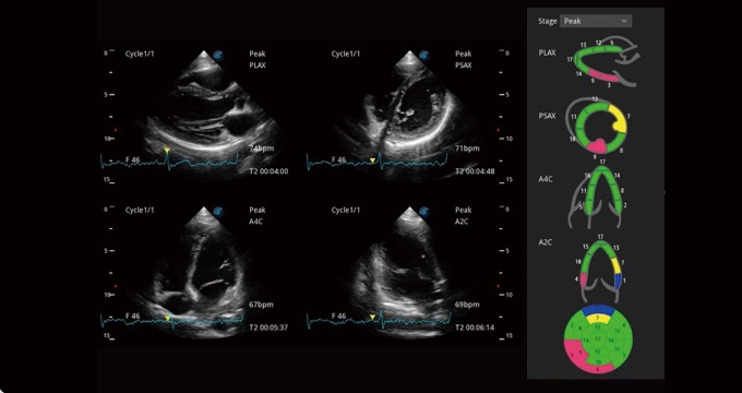 SonoScape P25 pro SonoScape P25 pro
