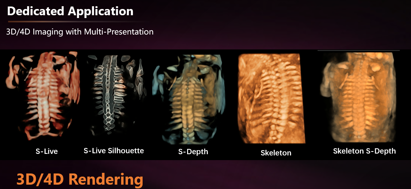 sonoscape-p25 sonoscape-p25