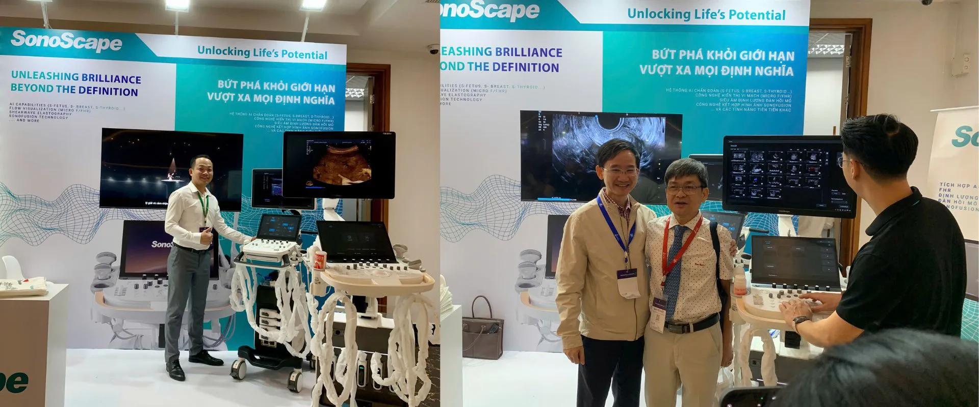 Máy siêu âm SonoScape 