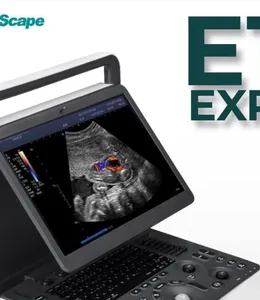 Máy siêu âm xách tay SonoScape E1 Exp