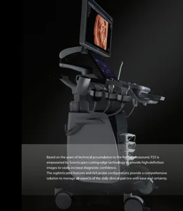 Máy siêu âm 5D SonoScape P25