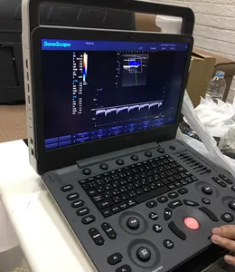 Máy siêu âm xách tay SonoScape E1 Exp