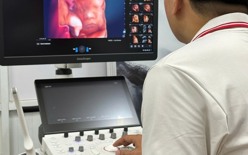 BÀN GIAO MÁY SIÊU ÂM SONOSCAPE P25 PRO FULL 5 ĐẦU DÒ TẠI LONG AN NGÀY 7/2/2026