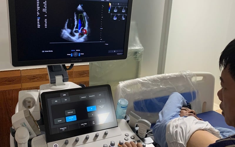 Công Ty TNHH Thiết Bị Y Tế Phú Việt - Triển khai lắp đặt máy siêu âm 5D SonoScape S55 tại Hà Nội