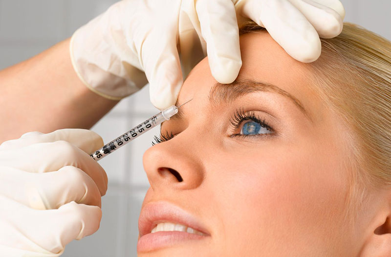 Những điều cần biết trước khi tiêm Botox