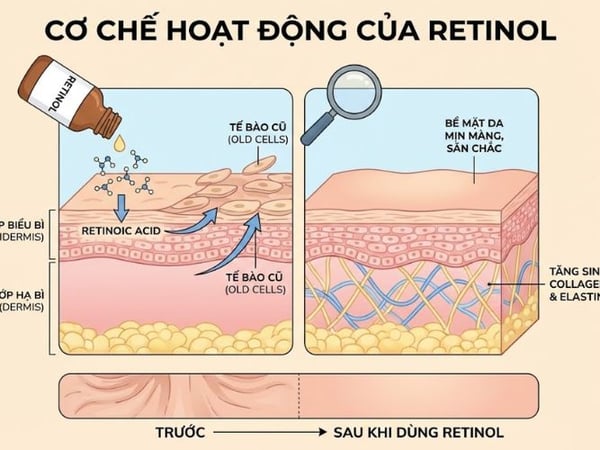 Retinol có thực sự “thần thánh”? Ai nên và không nên dùng?
