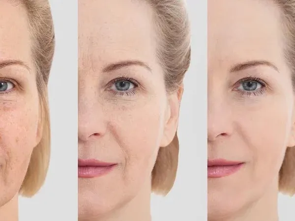 Collagen giảm theo tuổi như thế nào? Hiểu đúng để làm chậm lão hóa từ gốc