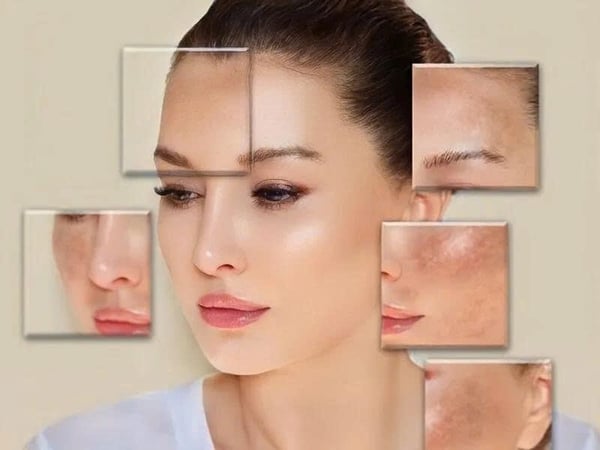 Da xỉn màu, không đều màu: Nguyên nhân sâu xa & cách phục hồi làn da rạng rỡ