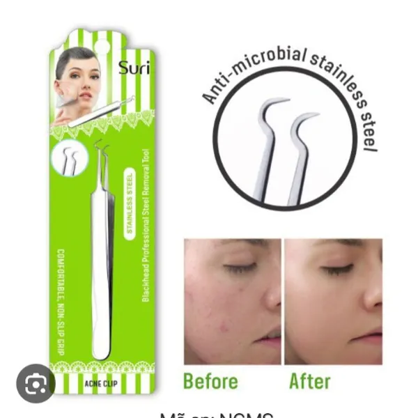 Nhíp gắp mụn suri