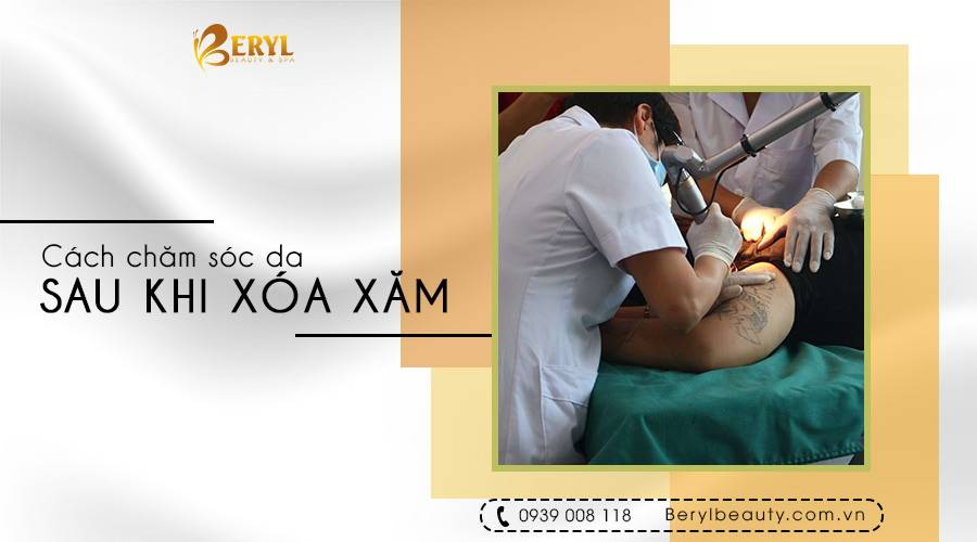 Những cách chăm sóc da sau khi xóa xăm Những cách chăm sóc da sau khi xóa xăm