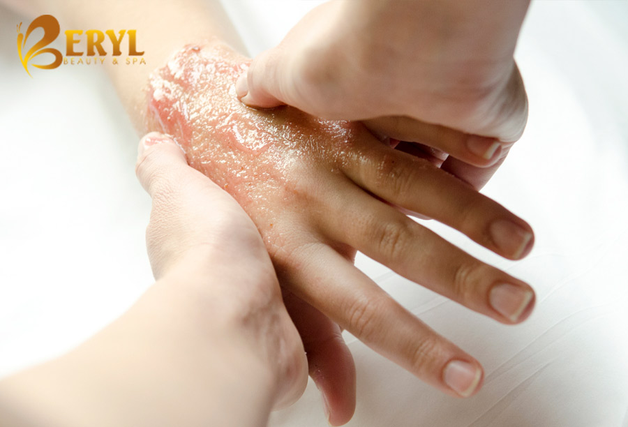 Giải pháp dưỡng trẻ hóa da tay hiệu quả tại Beryl Beauty Giải pháp dưỡng trẻ hóa da tay hiệu quả tại Beryl Beauty