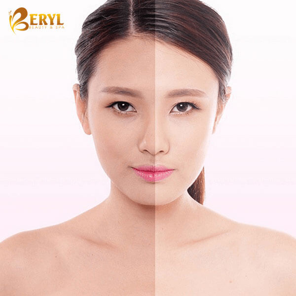 cach-lam-trang-da-toan-than-nhanh-trong-1-tuan cach-lam-trang-da-toan-than-nhanh-trong-1-tuan