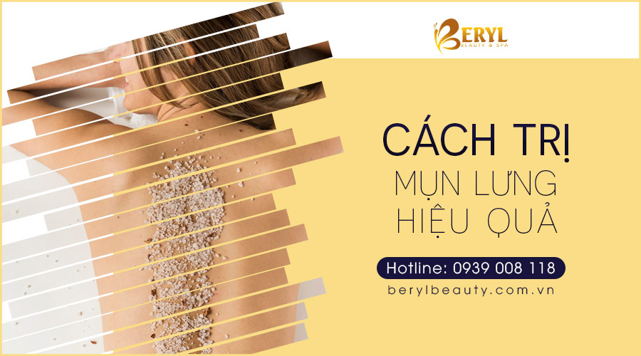 Bạn đã biết cách trị mụn ở lưng hiệu quả chưa? Bạn đã biết cách trị mụn ở lưng hiệu quả chưa?