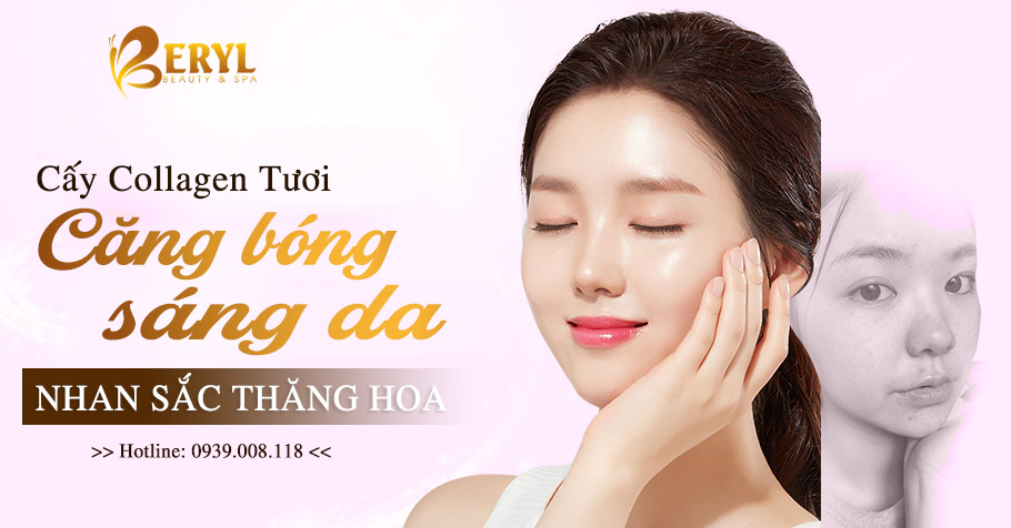 Cấy collagen tươi - Sở hữu làn da căng bóng mướt mịn