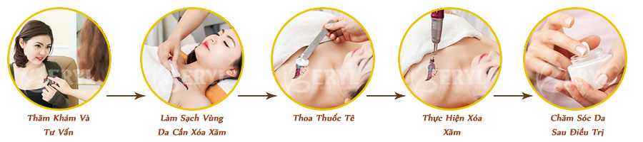Quy trình xóa hình xăm an toàn tại Beryl Beauty & Spa TPHCM Quy trình xóa hình xăm an toàn tại Beryl Beauty & Spa TPHCM