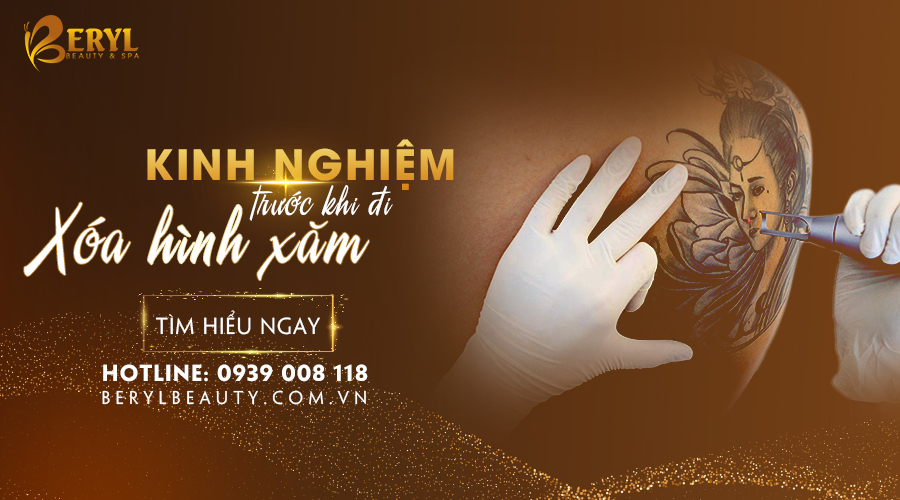 Kinh nghiệm trước khi đi xóa xăm. Kinh nghiệm trước khi đi xóa xăm.