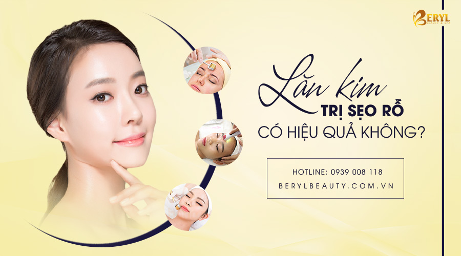 Lăn kim trị sẹo rỗ có hiệu quả không? Lăn kim trị sẹo rỗ có hiệu quả không?