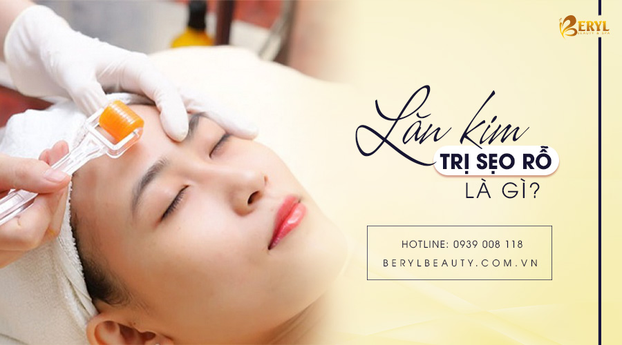 Lăn kim trị sẹo rỗ là gì? Lăn kim trị sẹo rỗ là gì?