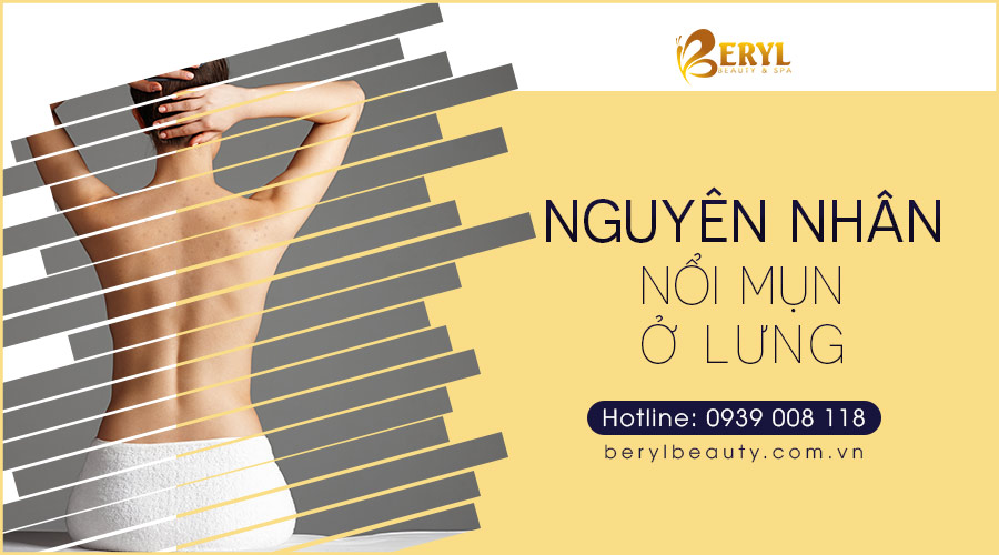 Nguyên nhân nổi mụn ở lưng là do đâu? Nguyên nhân nổi mụn ở lưng là do đâu?