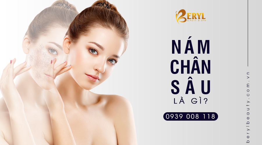 Bạn có biết nguyên nhân nào dẫn đến nám chân sâu không? Bạn có biết nguyên nhân nào dẫn đến nám chân sâu không?