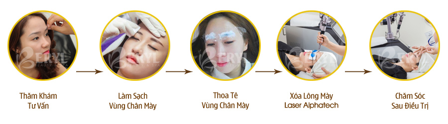Quy trình xóa xăm lông mày bằng Laser Alphatech Pro tại Beryl Beauty & Spa Quy trình xóa xăm lông mày bằng Laser Alphatech Pro tại Beryl Beauty & Spa