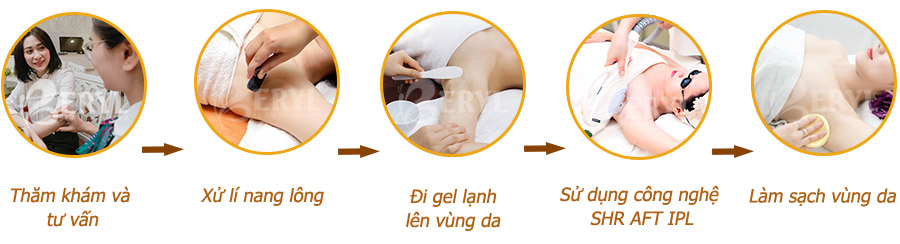 Quy tình triệt lông an toàn tại Beryl Beauty quận Bình Thạnh Quy tình triệt lông an toàn tại Beryl Beauty quận Bình Thạnh