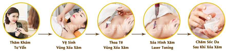 Quy trình xóa xăm bằng Laser Toning thế hệ mới tại Beryl Beauty & Spa Quy trình xóa xăm bằng Laser Toning thế hệ mới tại Beryl Beauty & Spa