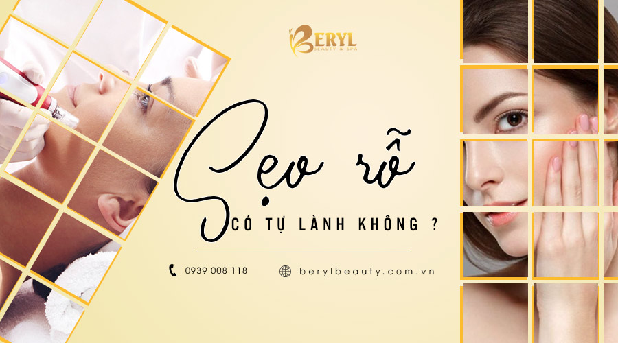 Sẹo rỗ có tự lành được không? Sẹo rỗ có tự lành được không?