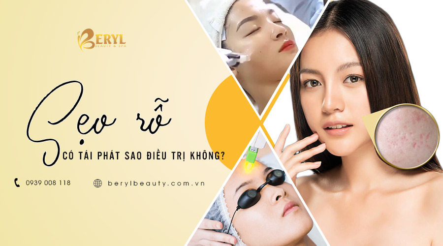 Sẹo rỗ có tái phát sau khi điều trị không? Sẹo rỗ có tái phát sau khi điều trị không?