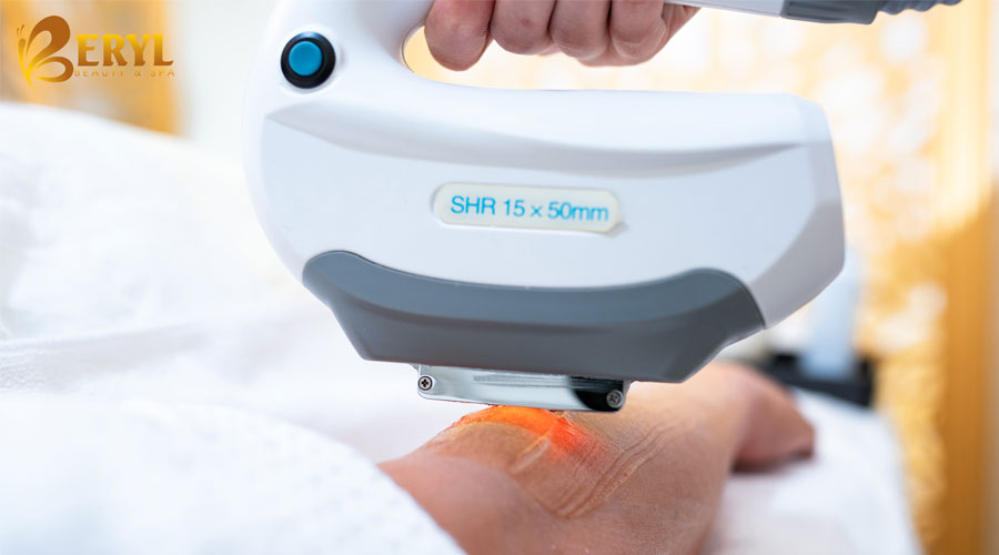 triệt-lông-bằng-công-nghệ-nào-tốt triệt-lông-bằng-công-nghệ-nào-tốt