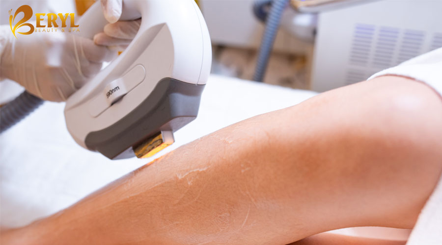 triệt-lông-chân-hết-bao-nhiêu-tiền triệt-lông-chân-hết-bao-nhiêu-tiền