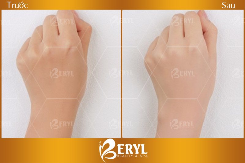 Hình ảnh khi tắm trắng tại Beryl Beauty quận Bình Thạnh TPHCM Hình ảnh khi tắm trắng tại Beryl Beauty quận Bình Thạnh TPHCM