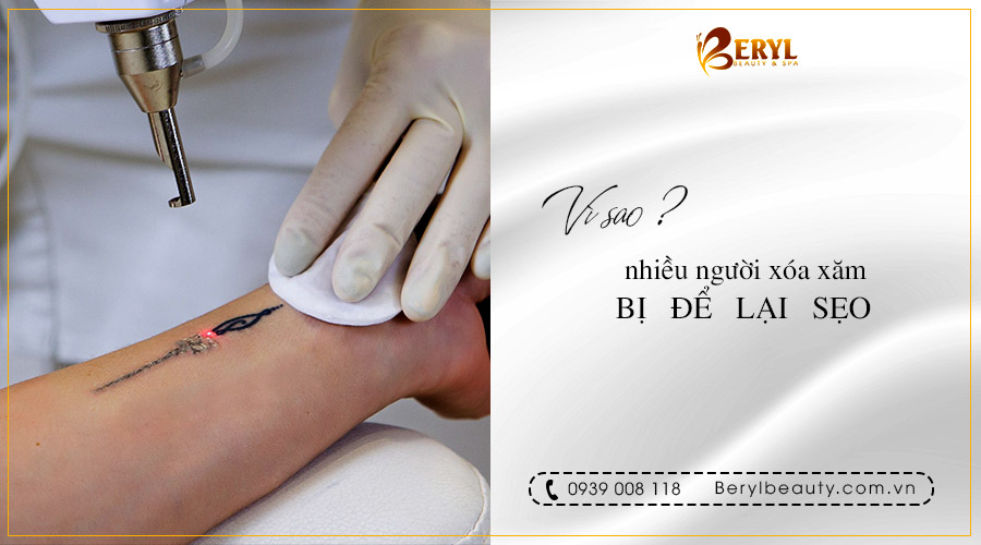 Vì sao nhiều người xóa xăm bị để lại sẹo? Vì sao nhiều người xóa xăm bị để lại sẹo?