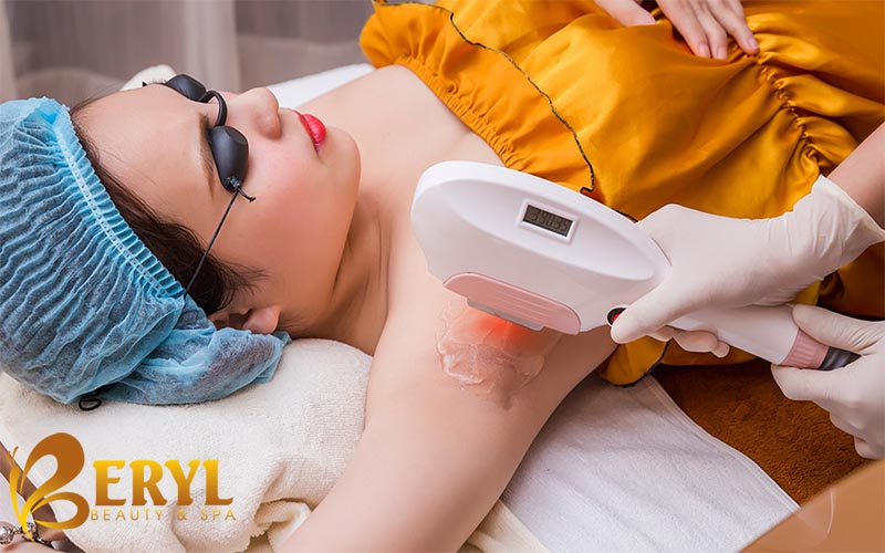 Bảng giá triệt lông từng vùng bằng công nghệ cao tại Beryl Beauty Bảng giá triệt lông từng vùng bằng công nghệ cao tại Beryl Beauty