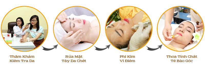 Quy trình điều trị sẹo rỗ bằng công nghệ phi kim vi điểm tế bào gốc tại Beryl Beauty & Spa Quy trình điều trị sẹo rỗ bằng công nghệ phi kim vi điểm tế bào gốc tại Beryl Beauty & Spa