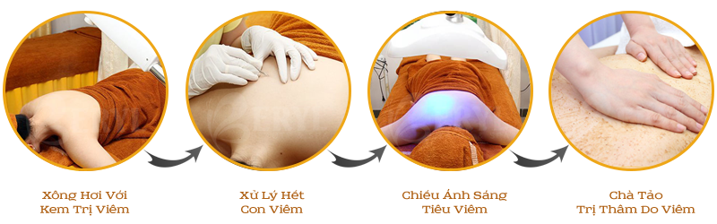 Quy trình điều trị viêm nang lông bằng ánh sáng sinh học tại Beryl Beauty Quy trình điều trị viêm nang lông bằng ánh sáng sinh học tại Beryl Beauty