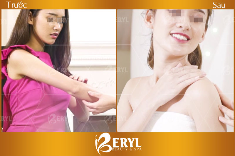 Hình ảnh trước và sau khi tắm trắng toàn thân bằng công nghệ vi tảo biển Nhật Hình ảnh trước và sau khi tắm trắng toàn thân bằng công nghệ vi tảo biển Nhật