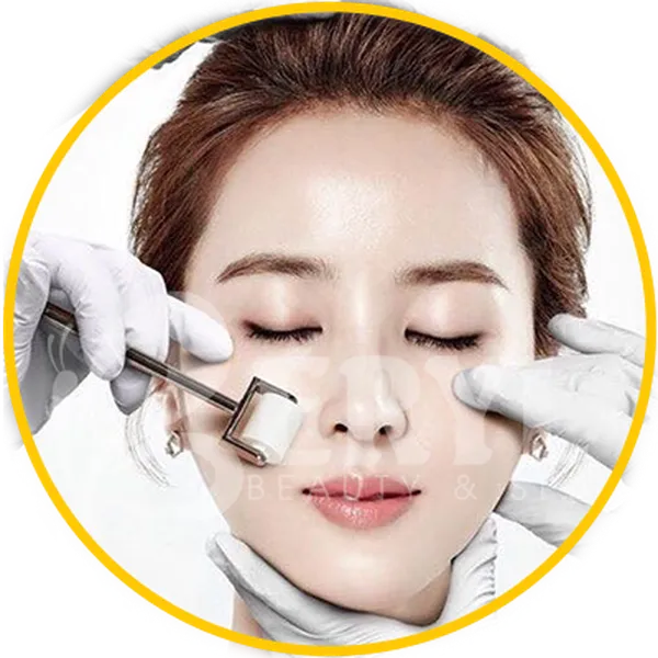 Lăn Kim Trị Sẹo Rỗ Giá Bao Nhiêu?