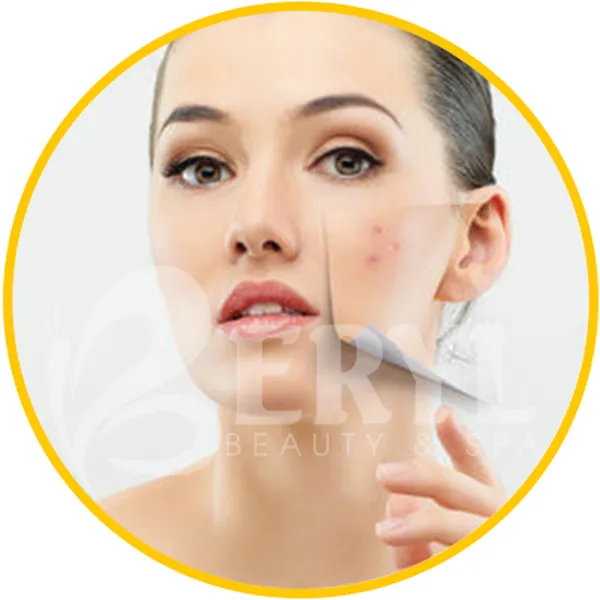 Spa Trị Thâm Mụn Hiệu Quả Và Uy Tín Tại TPHCM