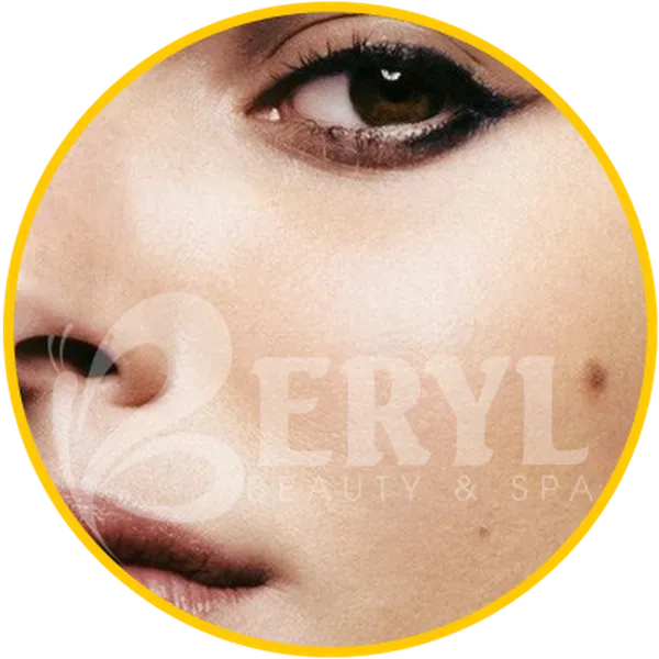 Tẩy Nốt Ruồi Ở Đâu - Địa Chỉ Tẩy Nốt Ruồi Ở TPHCM