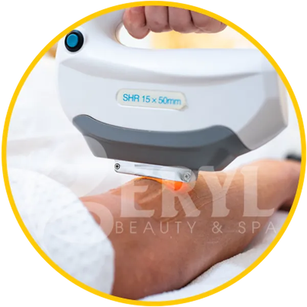 Triệt Lông Bằng Công Nghệ Nào Tốt - Beryl Beauty & Spa TPHCM