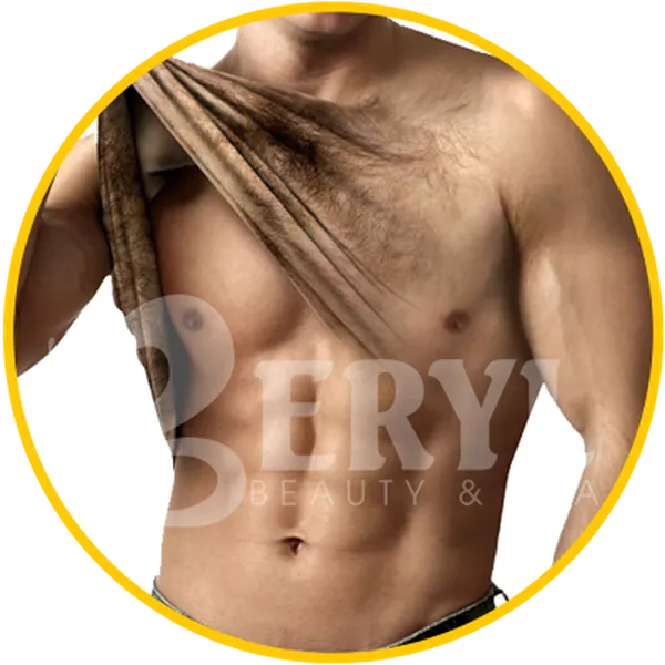 Triệt Lông Cho Nam - Spa Triệt Lông Nách Cho Nam Giới Tại TPHCM