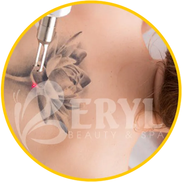 Xóa Hình Xăm Có Để Lại Sẹo Không ? Bảng Giá Xóa Xăm Không Sẹo