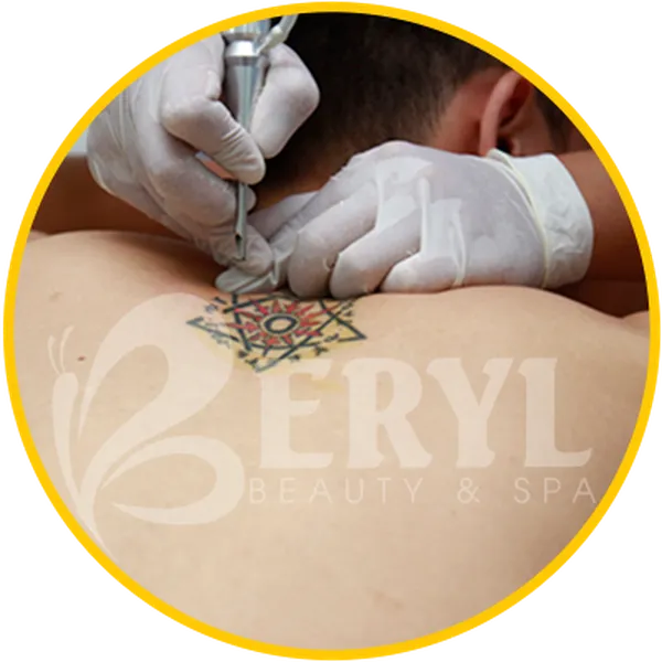 Xóa Hình Xăm Giá Bao Nhiêu Tiền - Bảng Giá Xóa Xăm 2024