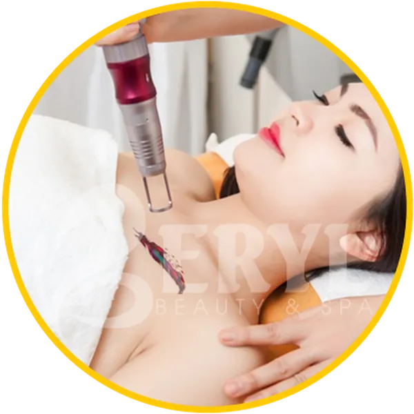 Xóa Xăm Bằng Laser - Xóa Hình Xăm Bằng Laser Toning Thế Hệ Mới