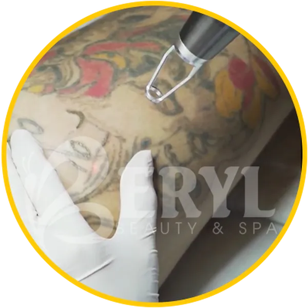 Xóa Xăm Hiệu Quả - Xóa Hình Xăm Hiệu Quả An Toàn Ở Beryl Beauty & Spa