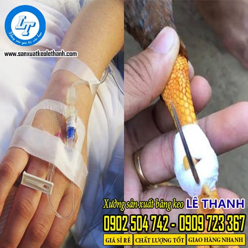 Ứng dụng của băng keo đá gà